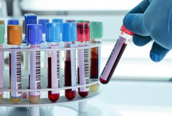 0001_laboratory-blood-samples-shutterstock_143897611-35s9p1am7tcxrhf0gptczk_1567085426-7a8bc8493736cd2b5f5c82785d946e69.jpg